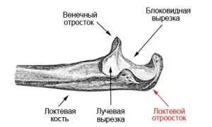 Перелом локтевого отростка: диагностика и лечение