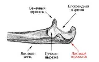 Перелом локтевого отростка: диагностика и лечение