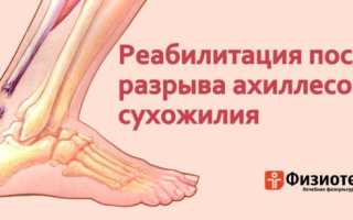 Восстановление после после разрыва ахиллова сухожилия