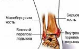 Сколько держится отек после перелома руки и как его можно убрать